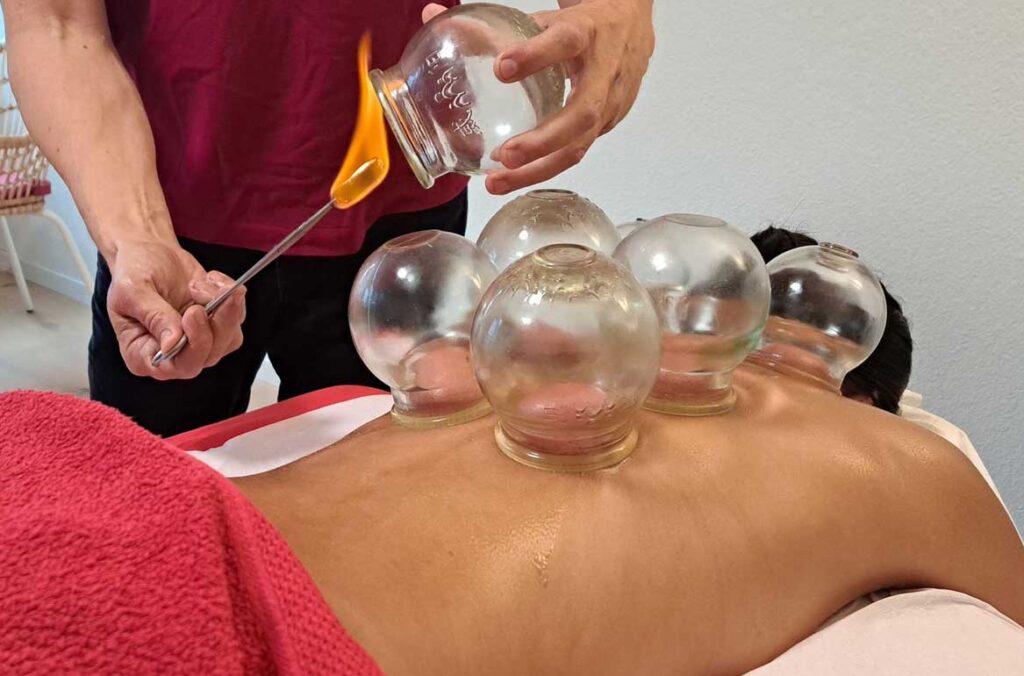 YUPEE TCM Schröpfen