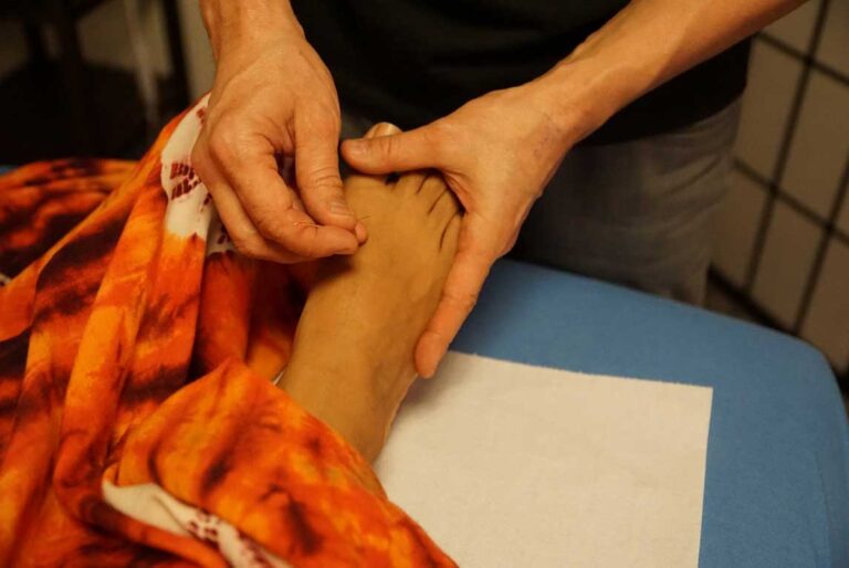 YUPEE TCM Akupunktur