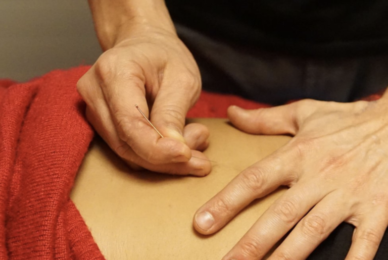 YUPEE TCM Akupunktur